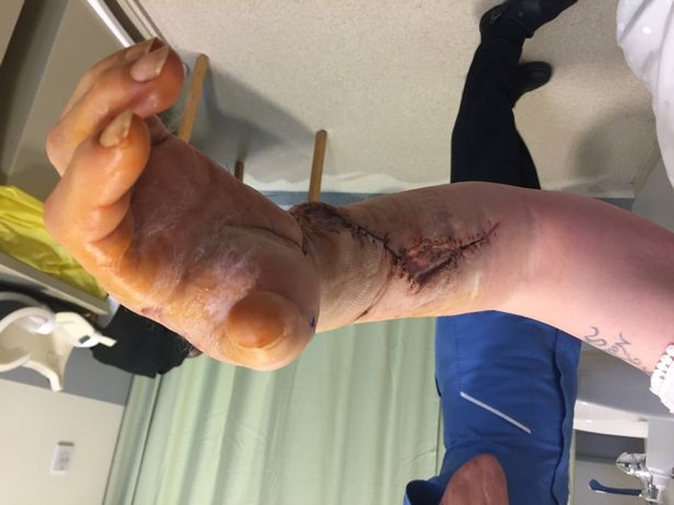 Suýt chết vì bị giường đè suốt 13 tiếng đồng hồ - 3