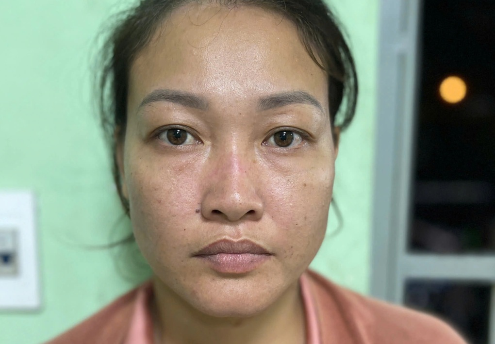 Đánh nhân viên gác chắn gãy mũi, có thể bị xử lý ra sao? - 1 Đánh nhân viên gác chắn gãy mũi, có thể bị xử lý ra sao? - 1