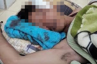 Mâu thuẫn trong bữa cơm, bị bạn cùng phòng dùng dao đâm vào đầu