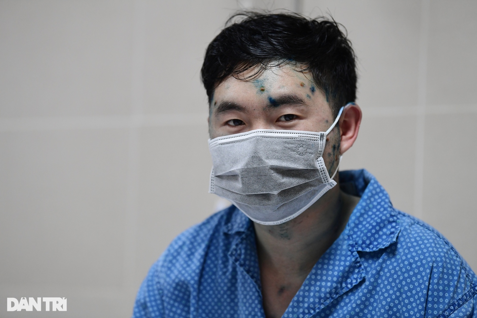 Hà Nội: Nhiều người nổi mụn nước chi chít phải nhập viện vì dịch bất thường - 7 Hà Nội: Nhiều người nổi mụn nước chi chít phải nhập viện vì dịch bất thường - 7