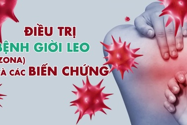 Những điều cần biết về bệnh Zona