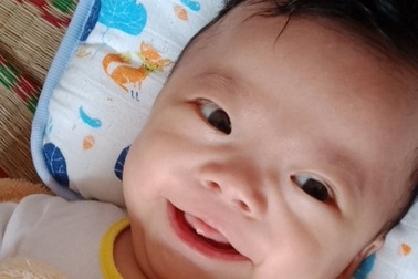 Nhói lòng cảnh bé trai 4 tháng tuổi mang trong mình căn bệnh quái ác