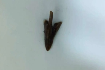 Hà Nội: Nhập viện vì thủ phạm không ngờ sau khi ăn thịt gà