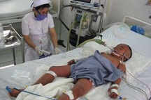 Cứu sống cháu bé bị sốt xuất huyết nặng