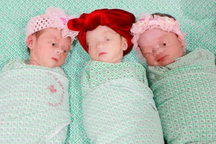 Hà Nội: Ca sinh rất hiếm gặp chỉ có 1/200.000 trường hợp