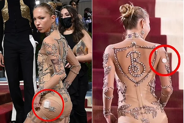 Mặc váy xuyên thấu, con gái siêu mẫu Kate Moss lộ máy đo đường huyết