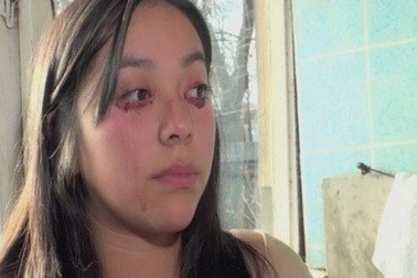 Gặp cô gái khóc ra... máu