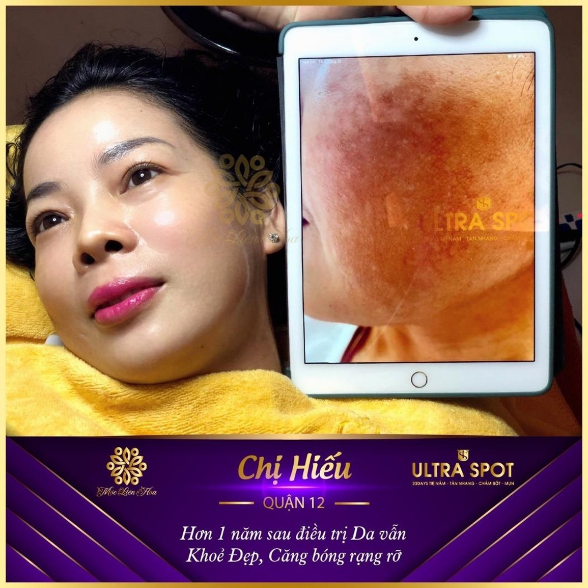 Hệ thống thẩm mỹ viện Thảo Vy - hành trình 20 năm tâm sắc song hành - 5 Hệ thống thẩm mỹ viện Thảo Vy - hành trình 20 năm tâm sắc song hành - 5
