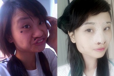 Cô gái 9x "xấu lạ" thừa nhận "dao kéo" để tự tin hơn