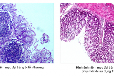 Nghiên cứu về Tràng Phục Linh Plus đăng trên Pubmed