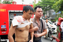 Lãnh đạo Công an Hà Nội thăm chiến sĩ bị thương khi chữa cháy