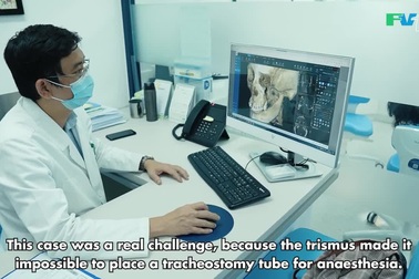 Phẫu thuật thành công cho người phụ nữ sau 23 năm bị cứng khít hàm