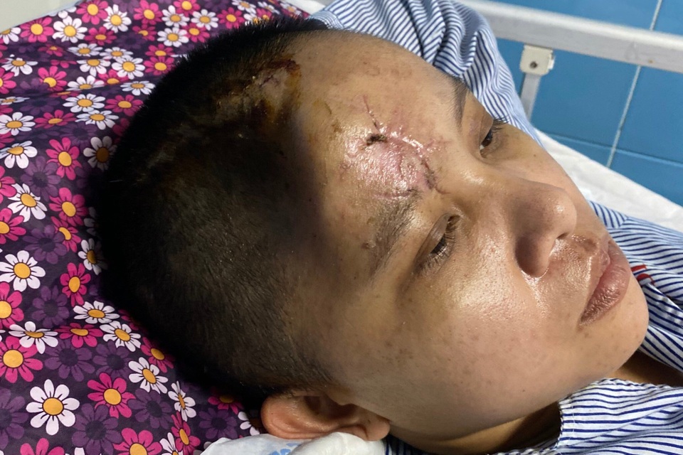 Người mẹ nghèo: Tôi quỳ gối, cúi đầu xin mọi người giúp đỡ cứu lấy cháu - 2 Người mẹ nghèo: Tôi quỳ gối, cúi đầu xin mọi người giúp đỡ cứu lấy cháu - 2