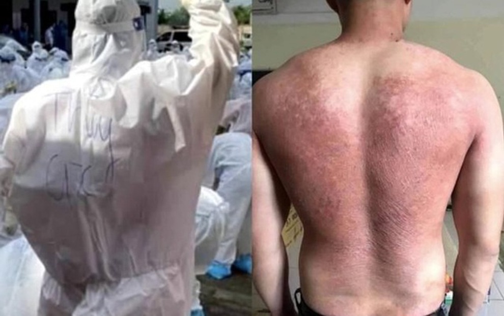 Những câu chuyện cảm động trong cuộc chiến chống dịch gây sốt dân mạng - 16