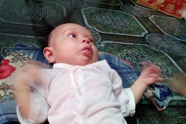 Bé gái 5 tháng tuổi khốn khổ với đủ thứ bệnh hành hạ cơ thể