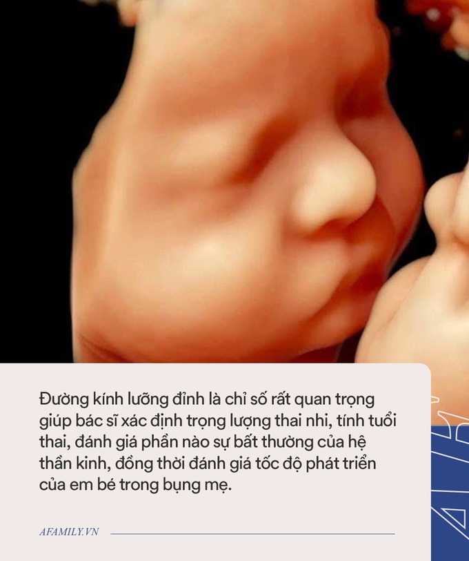 Siêu âm thai, mẹ bầu chỉ chăm chăm xem chiều cao và cân nặng của con nhưng bác sĩ chỉ rõ nên để ý cả đến 2 chỉ số khác - Ảnh 1. Siêu âm thai, mẹ bầu chỉ chăm chăm xem chiều cao và cân nặng của con nhưng bác sĩ chỉ rõ nên để ý cả đến 2 chỉ số khác - Ảnh 1.