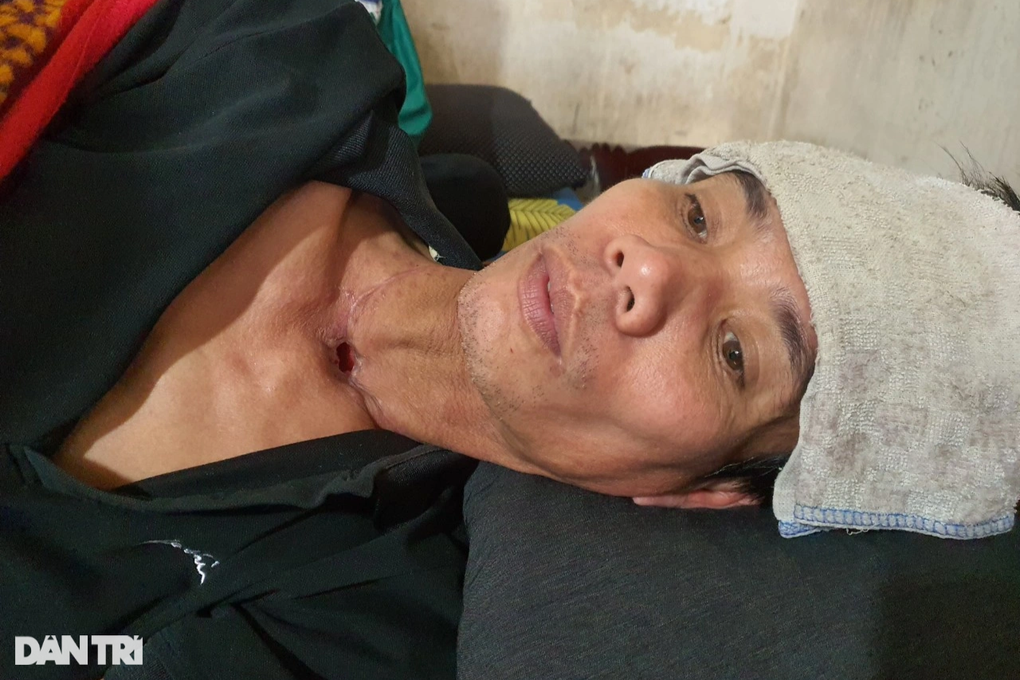 Người cha ung thư thanh quản và lời cầu xin nguệch ngoạc trên mẩu giấy - 2 Người cha ung thư thanh quản và lời cầu xin nguệch ngoạc trên mẩu giấy - 2