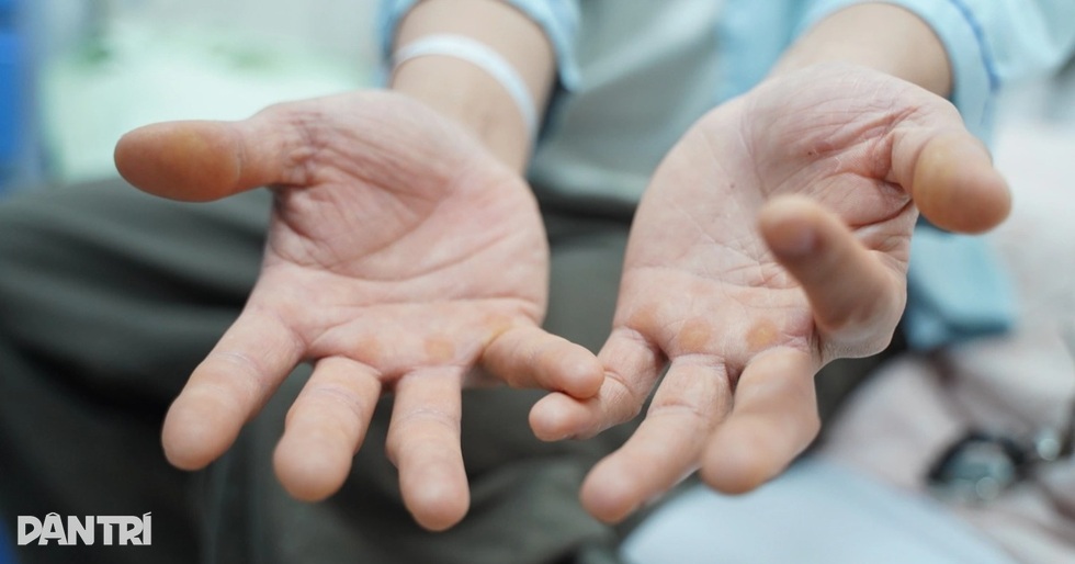 “Đốt tiền vào bóng cười, vợ chồng 9X liệt chân, giảm trí nhớ - 3 “Đốt tiền vào bóng cười, vợ chồng 9X liệt chân, giảm trí nhớ - 3