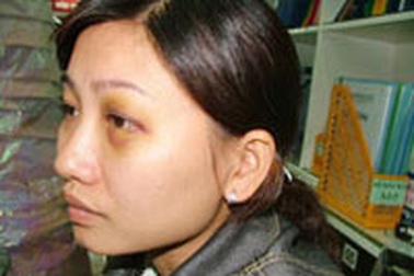 Hành hung nhân viên của đối thủ để cạnh tranh?