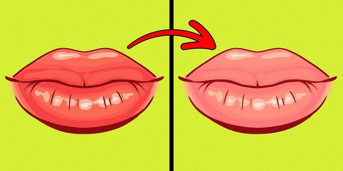 8 dấu hiệu của đôi môi tiết lộ tình trạng sức khoẻ của bạn - Ảnh 6. 8 dấu hiệu của đôi môi tiết lộ tình trạng sức khoẻ của bạn - Ảnh 6.