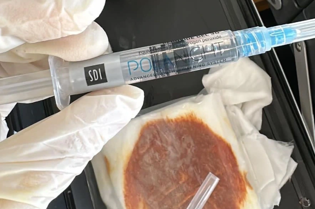 Hoại tử mi mắt vì spa tiêm ống oxy già tẩy trắng răng để làm đẹp - 1