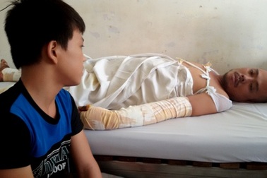 Cưa phuy đựng dầu, thợ hồ bỏng nặng sau tiếng nổ như bom