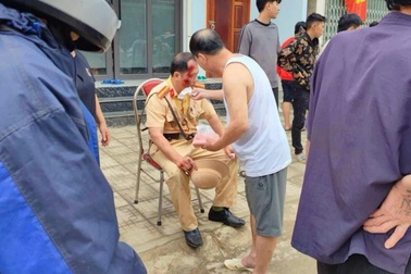 Thiếu tá CSGT bị "quái xế" tông bị thương khi làm nhiệm vụ