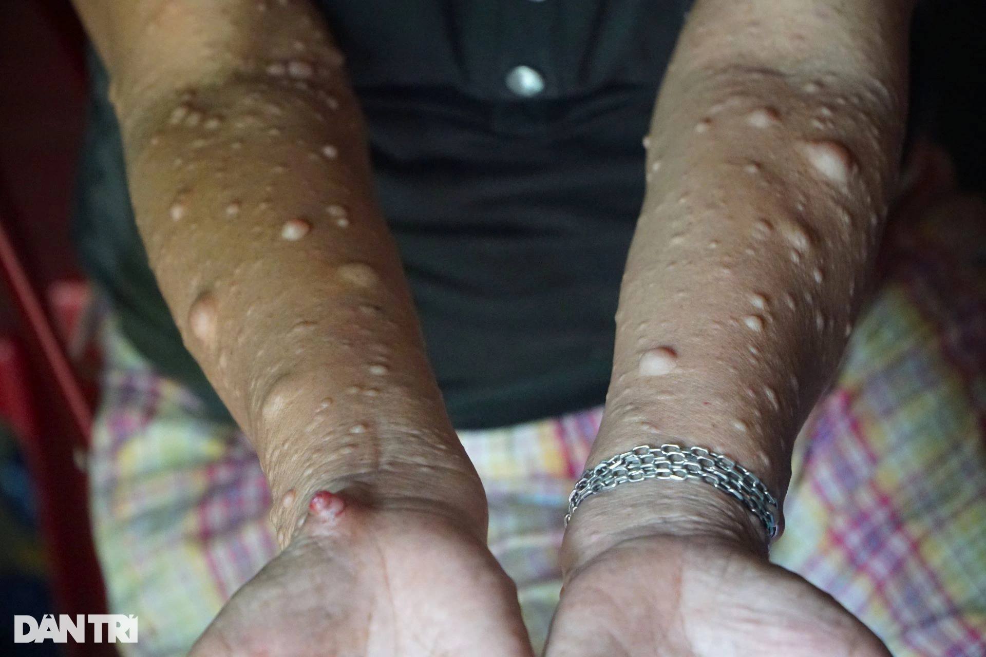 Sóng gió cuộc đời người đàn bà mang khuôn mặt quỷ - 4 Sóng gió cuộc đời người đàn bà mang khuôn mặt quỷ - 4