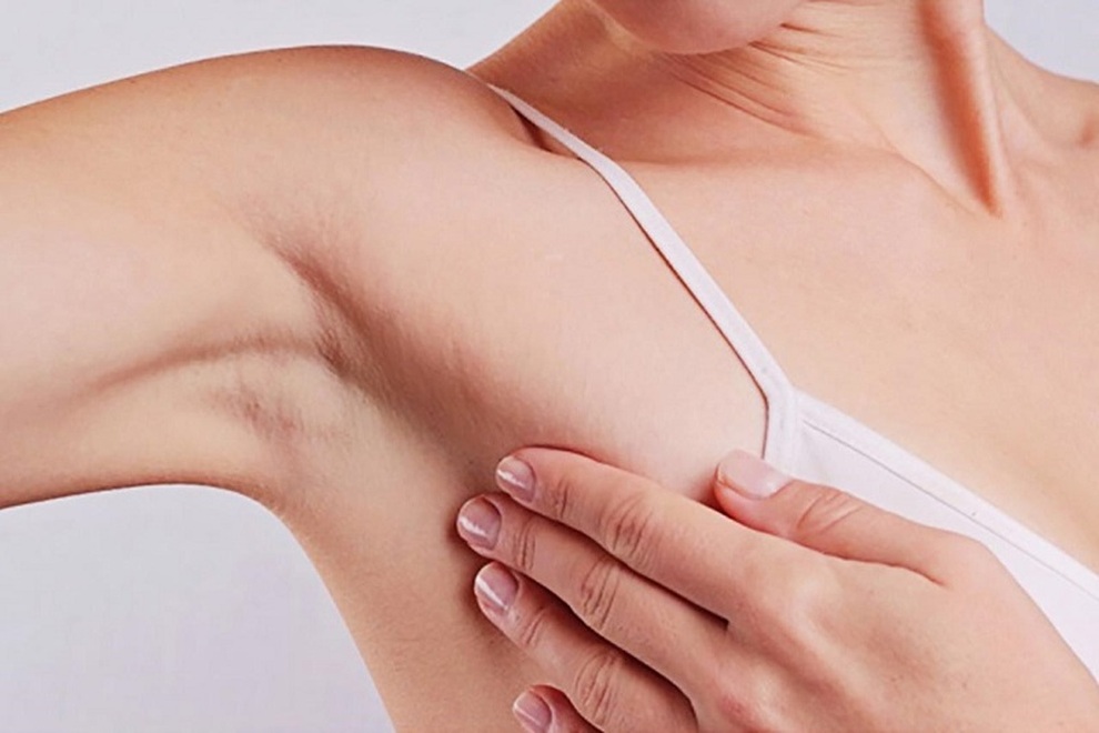 Loại ung thư dễ phát hiện nhất, vẫn có 50% bệnh nhân đến viện khi đã muộn - 1 Loại ung thư dễ phát hiện nhất, vẫn có 50% bệnh nhân đến viện khi đã muộn - 1