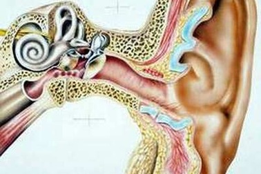 Nhiễm nấm vì ngoáy tai nhiều