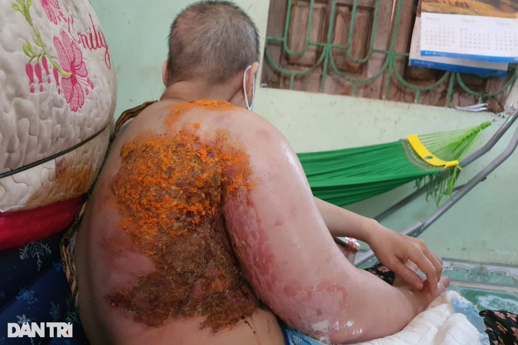 Người mẹ ung thư nghẹn ngào em không còn nước mắt để khóc - 1 Người mẹ ung thư nghẹn ngào em không còn nước mắt để khóc - 1