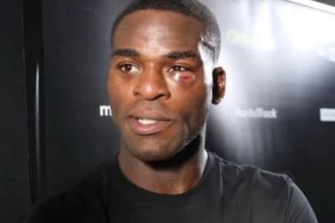 Đánh bại đối thủ, võ sĩ khoe mắt mình bị đấm sưng húp