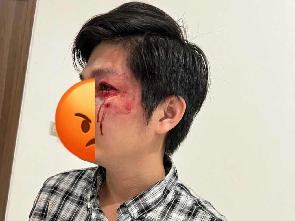 Chủ chó đấm người đàn ông bảo vệ con: Sốc vì anh ấy đá chó còn quá nhỏ - 1 Chủ chó đấm người đàn ông bảo vệ con: Sốc vì anh ấy đá chó còn quá nhỏ - 1