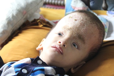 “Đầu cháu sắp nổ tung, nhưng vợ chồng em cùng đường rồi !”