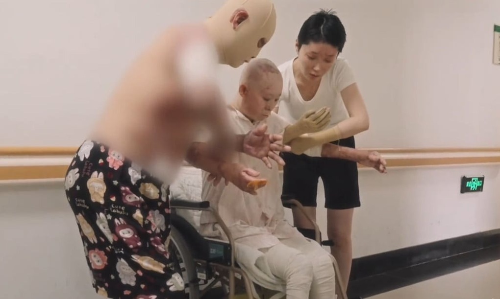 Bỏng nặng suýt mất tất cả, cựu mẫu gây sốt với nghề mới - 2 Bỏng nặng suýt mất tất cả, cựu mẫu gây sốt với nghề mới - 2