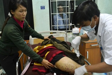 Bảo vệ dùng súng hoa cải bắn người dân bị thương nặng