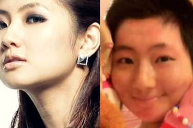 Cận cảnh gương mặt thật của Selina sau vụ bỏng