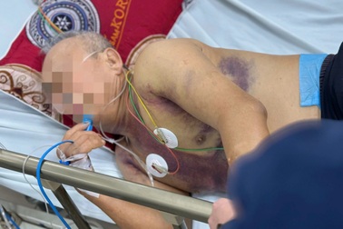 Mất một nửa lượng máu trong người vì... sốt xuất huyết