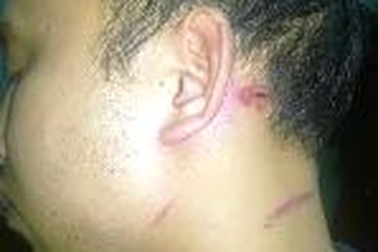 Dân tố bị cả Trưởng, Phó Công an xã đánh nhập viện