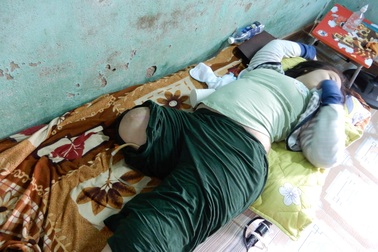 Dang dở đường đến trường của cô bé bị mất một chân vì bệnh u xương