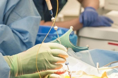 Vụ chồng chém lìa 2 cánh tay vợ: Một bên tay không nối lại được