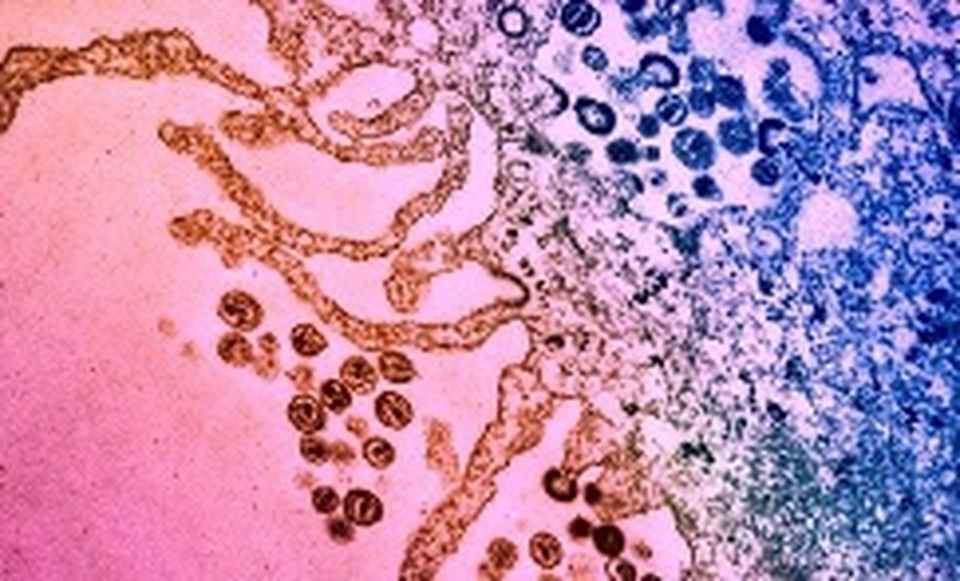 Phân tử kháng sinh cho phép hệ miễn dịch tiêu diệt tế bào nhiễm HIV - 1 Phân tử kháng sinh cho phép hệ miễn dịch tiêu diệt tế bào nhiễm HIV - 1