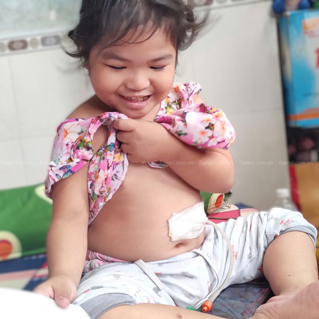 Bé gái 4 tuổi mắc ung thư, bị hẹp thực quản, bà ngoại từng mua sẵn quan tài - 2 Bé gái 4 tuổi mắc ung thư, bị hẹp thực quản, bà ngoại từng mua sẵn quan tài - 2