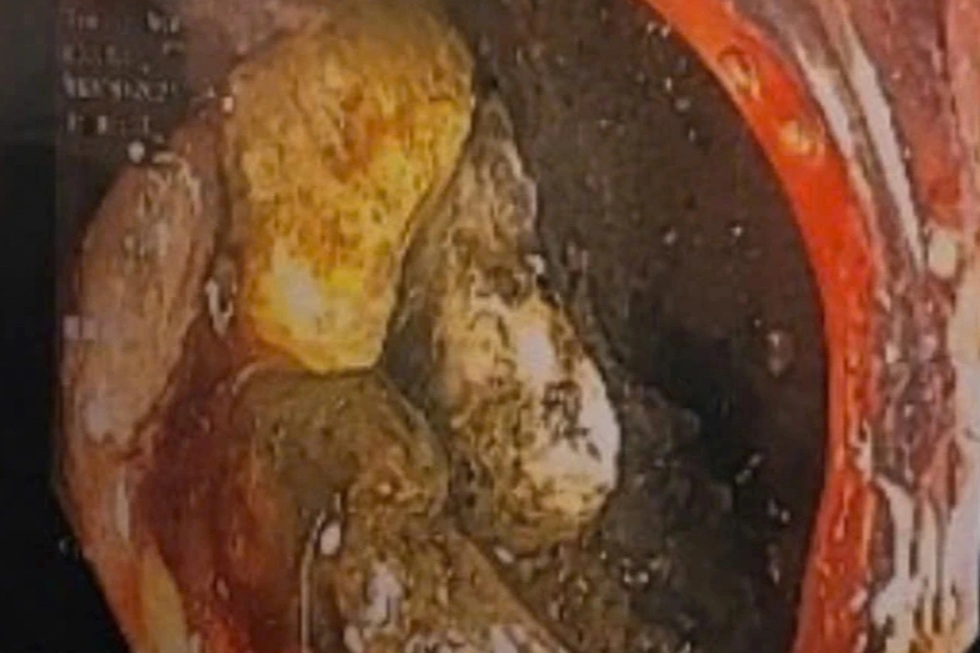 50 ngày dùng phác đồ chưa có tiền lệ hồi sinh em bé Làng Nủ - 4 50 ngày dùng phác đồ chưa có tiền lệ hồi sinh em bé Làng Nủ - 4