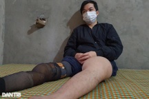 Ông bố trẻ đau khổ xin được cứu giúp để có tiền cắt nốt chiếc chân trái