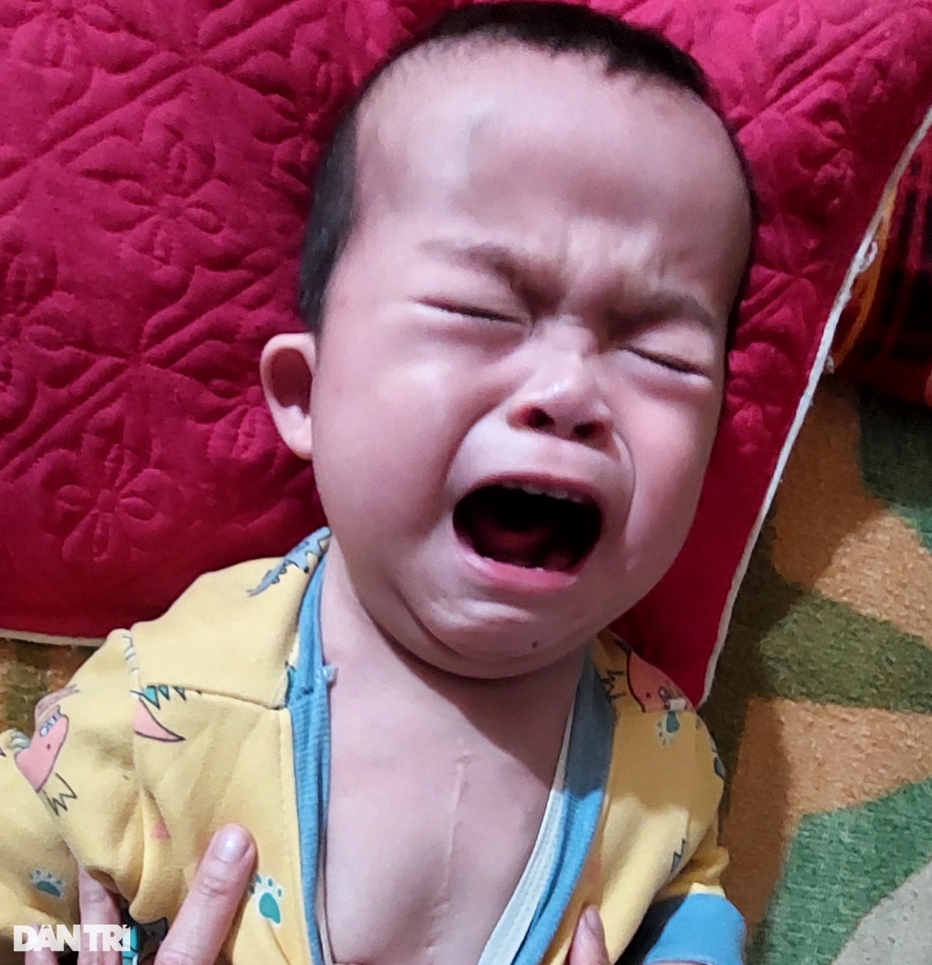 Bé trai 2 tuổi mang 2 căn bệnh hiểm, cha mẹ nghèo đau đớn, bất lực - 2 Bé trai 2 tuổi mang 2 căn bệnh hiểm, cha mẹ nghèo đau đớn, bất lực - 2