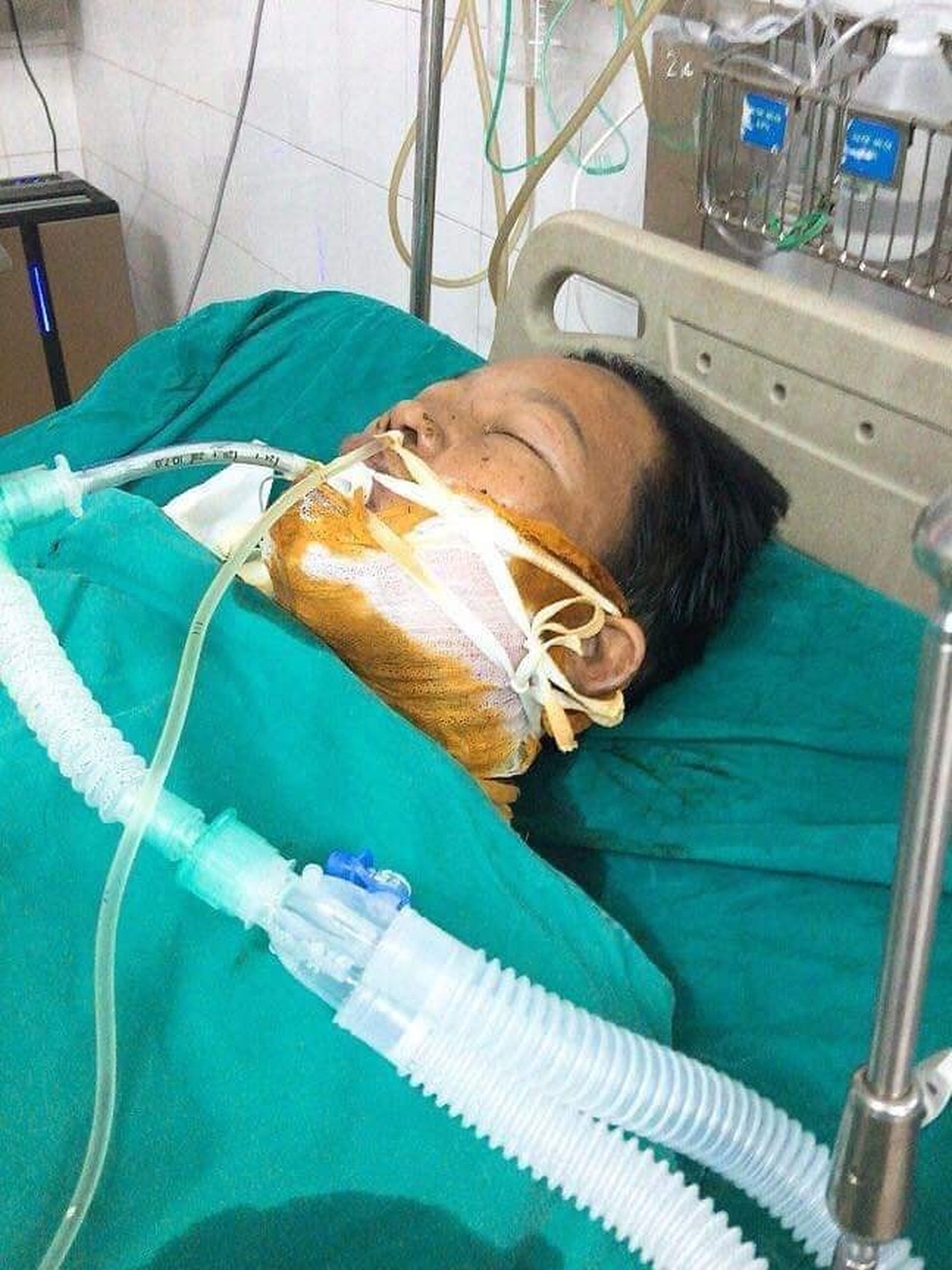 Nổ can xăng, 2 vợ chồng bỏng nặng - 1 Nổ can xăng, 2 vợ chồng bỏng nặng - 1