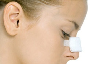 Các câu hỏi thường gặp về phẫu thuật thẩm mỹ