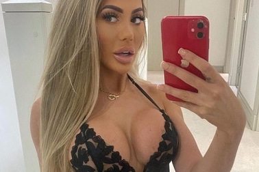 Chloe Ferry tuyên bố dừng phẫu thuật thẩm mỹ