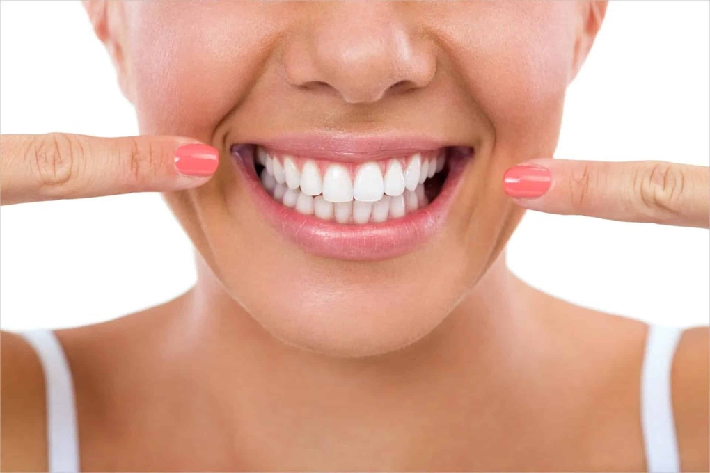 Mẹo hay để có được nụ cười hoàn hảo - 1 Mẹo hay để có được nụ cười hoàn hảo - 1
